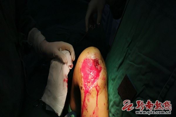 图片 5.jpg